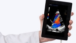 Allianz France fait un don au Resah de 1,5 million d'euros pour acquérir des échographes ultra-portables visant à aider les services d'urgences dans le diagnostic des patients Covid-19